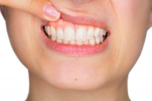 woman unsure about gum disease moorestown nj