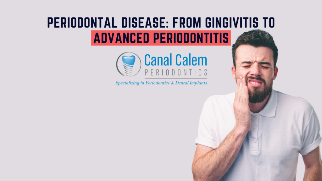 "Periodontal Disease: From Gingivitis to Advanced Periodontitis" in bold letter, the Canal Calem Logo and a patient holding his cheek with a presumed toothache. 